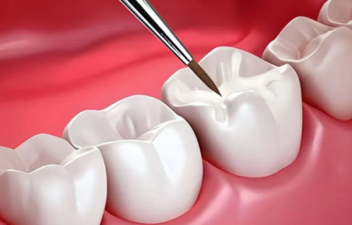 不可报销的情况