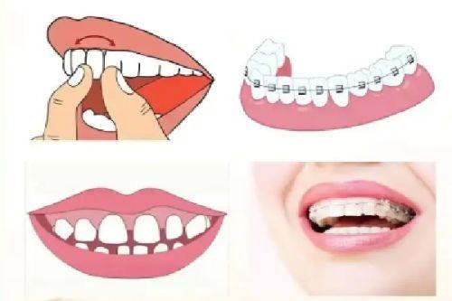 口腔黏膜问题不容忽视