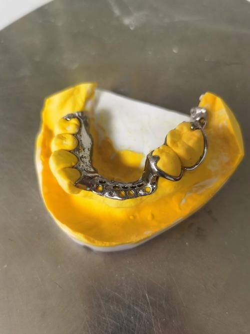 试戴与调改：确保舒适贴合