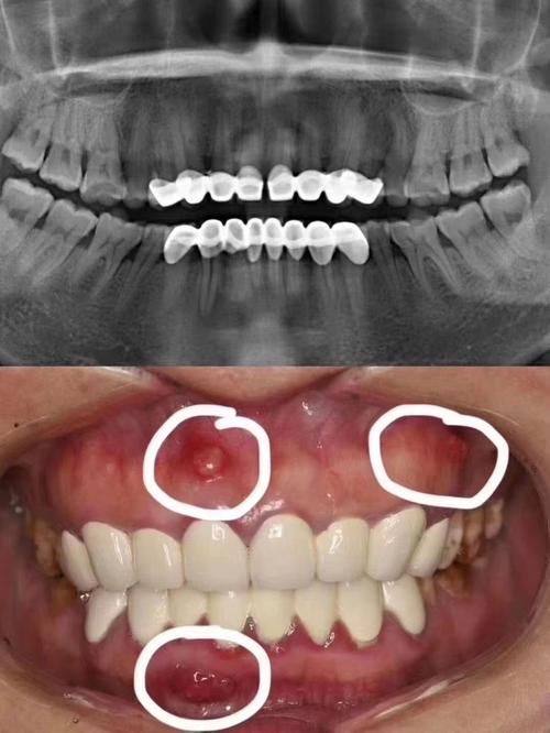 牙齿变色——焕白新生之路