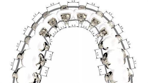 矫正方式选择的影响