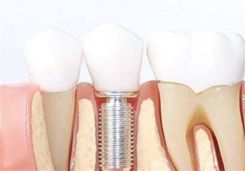 日常保健建议要重视