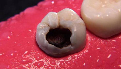 麻醉成效对治疗疼痛的作用