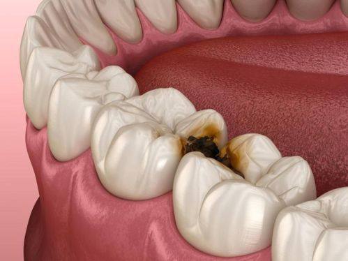 其他可能伴随的症状