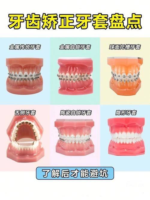 总体佩戴时长概述