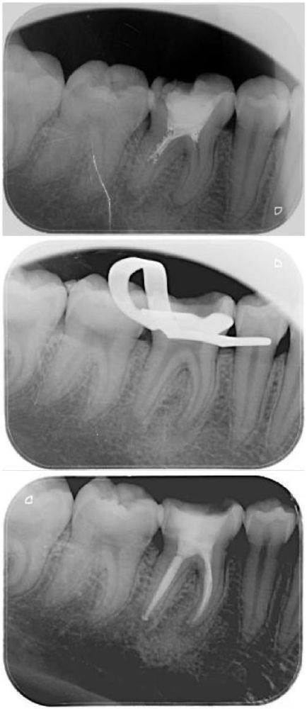 更痛苦步骤究竟是哪步