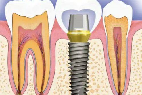 特殊情况需注意