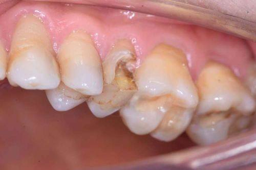 保养技巧延长使用寿命