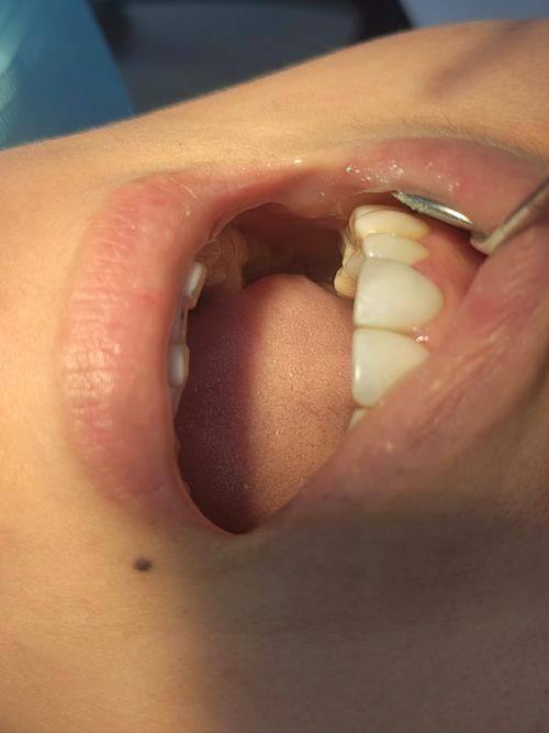 定期复查的意义