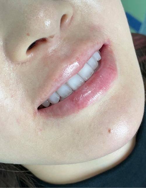 安心美白的决策建议