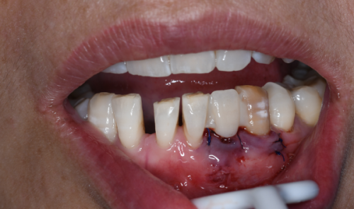 医生的处理原则对时间的影响