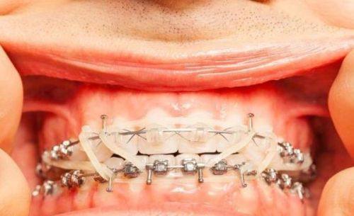 地区物价对矫正费用的影响