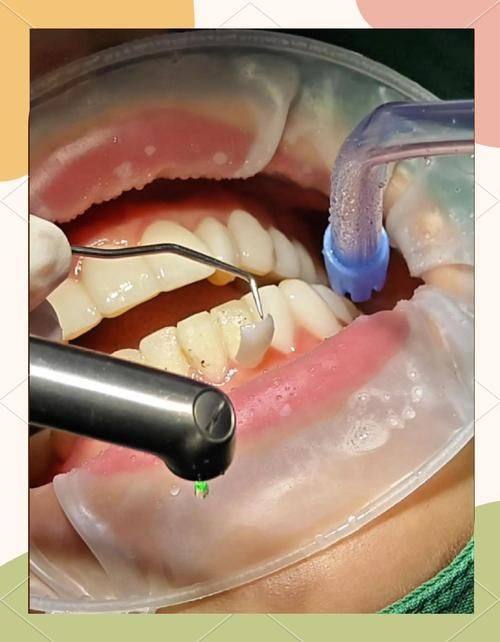 影响价格的因素