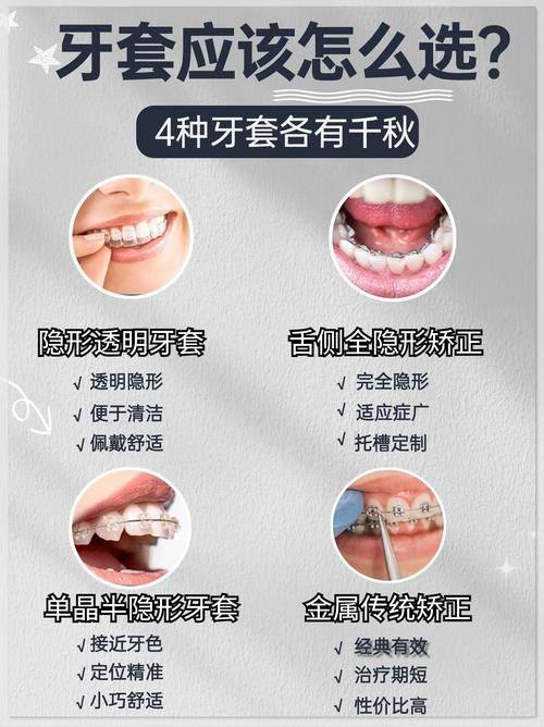 牙套价格的总体范围
