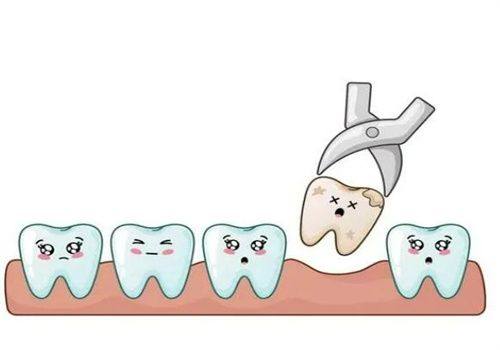 不同人群拔牙修复时间的差异