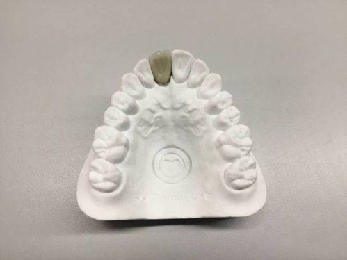 通常不可以矫正的情况