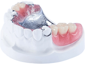 活动义齿支架的缺点