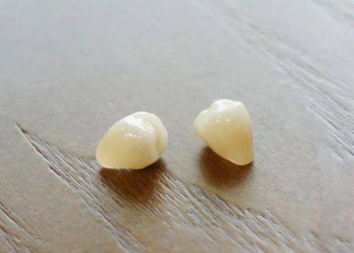 全瓷牙的使用建议