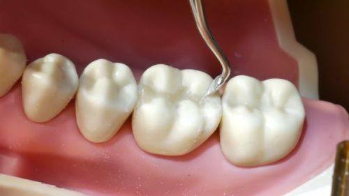 不同填充材料的维持时间差异