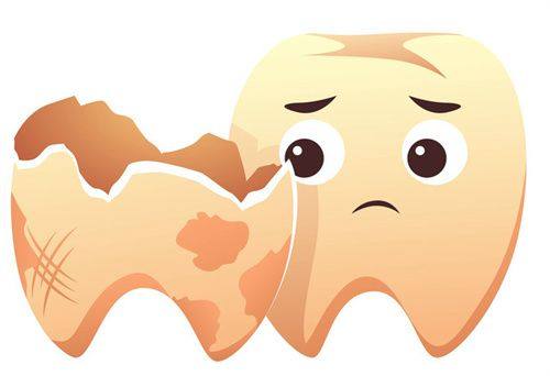 延长补牙维持年限的注意事项