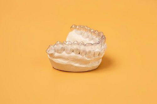 影响牙齿矫正时间的其他因素