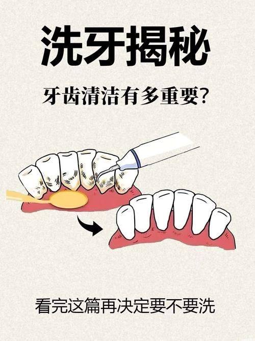 口腔专科医院洗牙科室选择