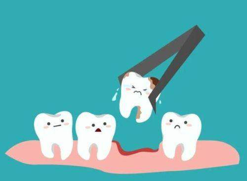 洗牙后注意事项：避免这5个常见错误，保护你的口腔健康！