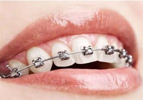 不同矫正方式所需时间差异