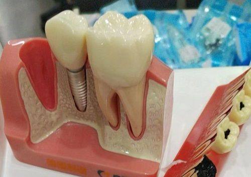 影响疼痛时间的因素之体质差异