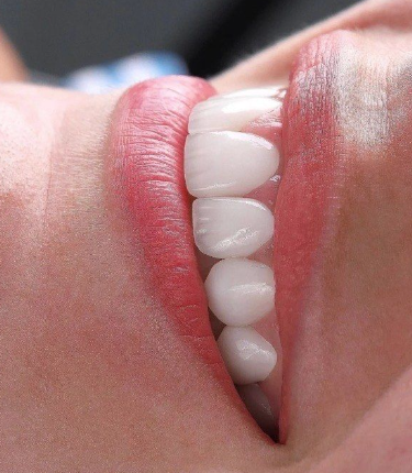 传统美白方法的“坑”