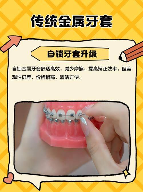 影响修复时间的因素