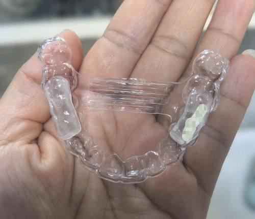 牙齿矫正能用医保报销吗？看完这5个要点你就明白！