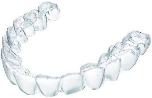 如何应对牙齿矫正费用问题