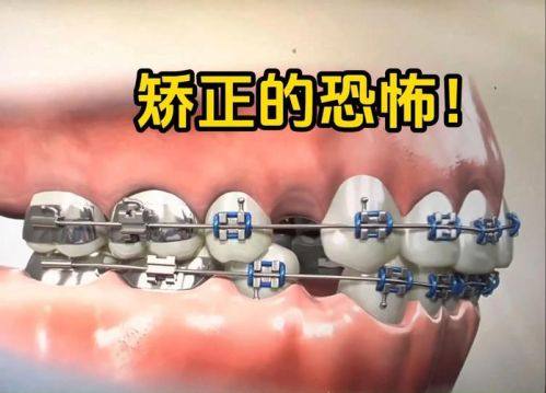 替代解决方案——商业牙科保险