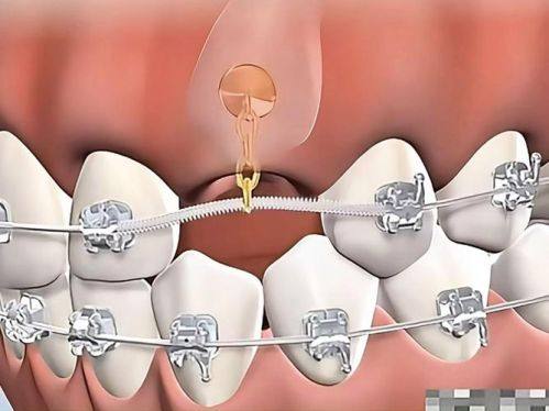 年龄对佩戴时长的影响