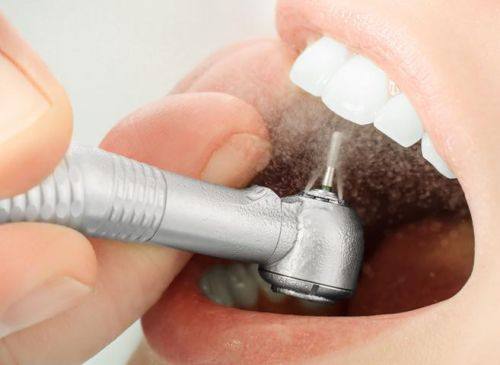 健康牙龈患者的判断方法