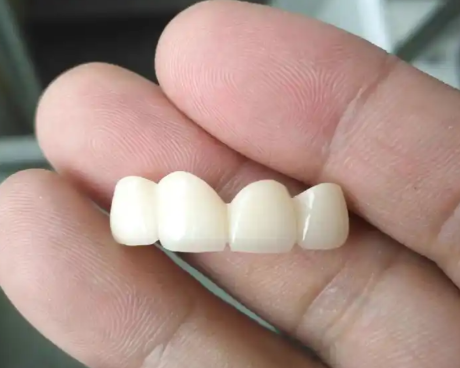 如何选择合适的全瓷牙