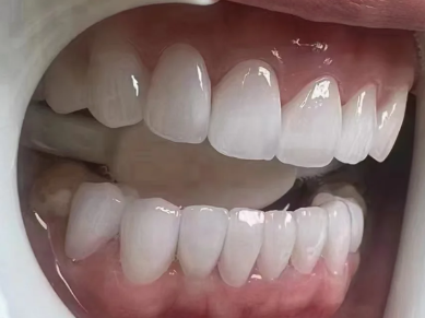 耐用性与适用情况