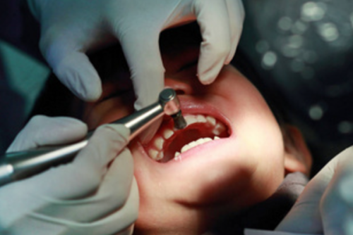 骨干医生建议：尽早拔除