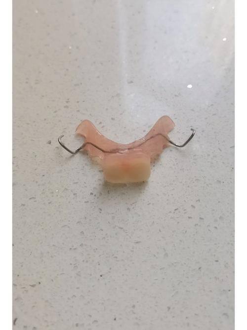 活动假牙的使用建议