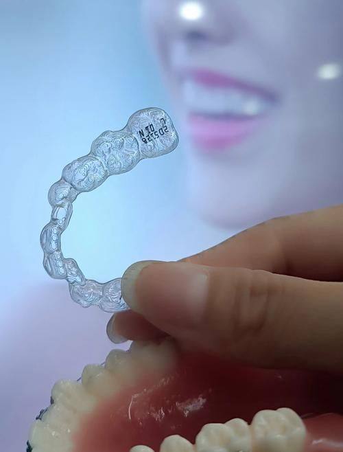 反(牙合)畸形:尽早干预是关键