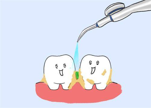 选择正规机构：洗牙安心的重要保护