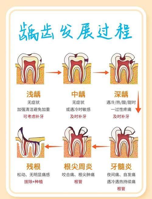 引发全身性疾病