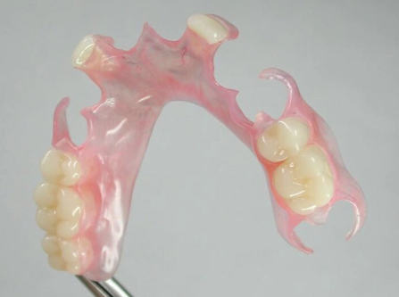 活动义齿材质哪种最耐用？揭秘3种最佳选择！