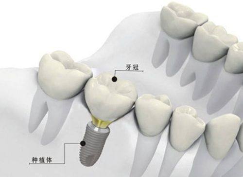 全身因素:整体健康不容忽视