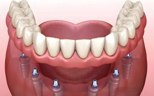 维护技巧:延长寿命的秘诀