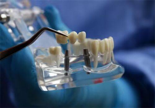 术后护理之饮食注意事项