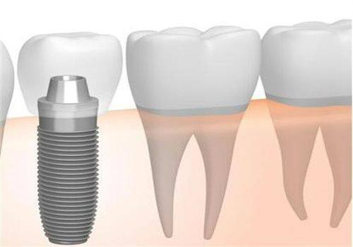 特殊情况导致的疼痛延长