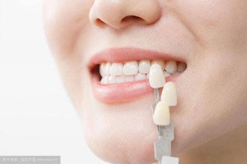 如何选择适合自己的牙齿美容方式