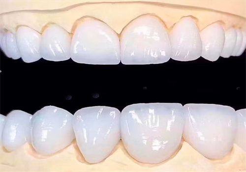 使用抗敏感牙膏